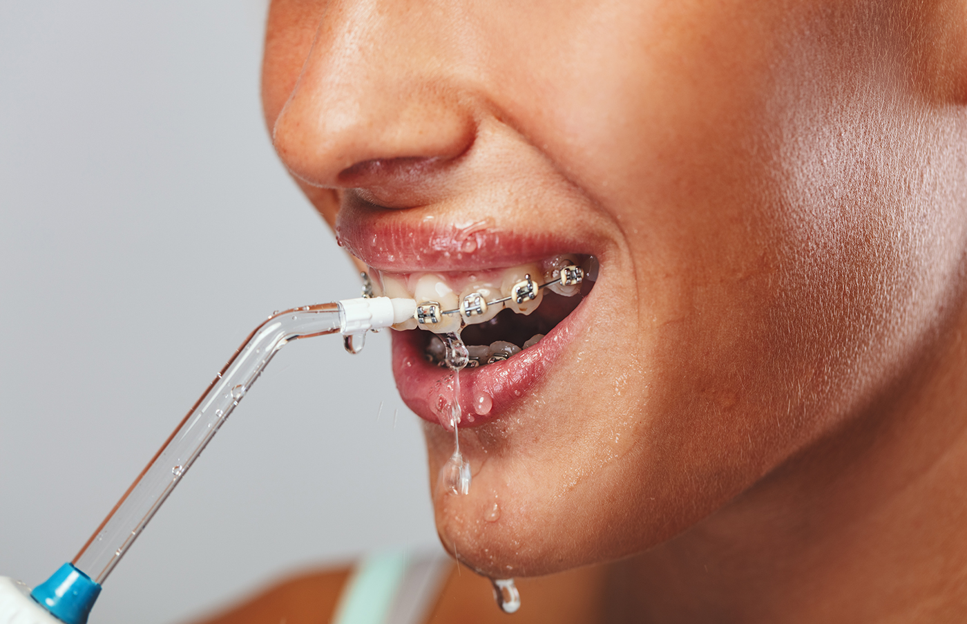 Braces Discomfort