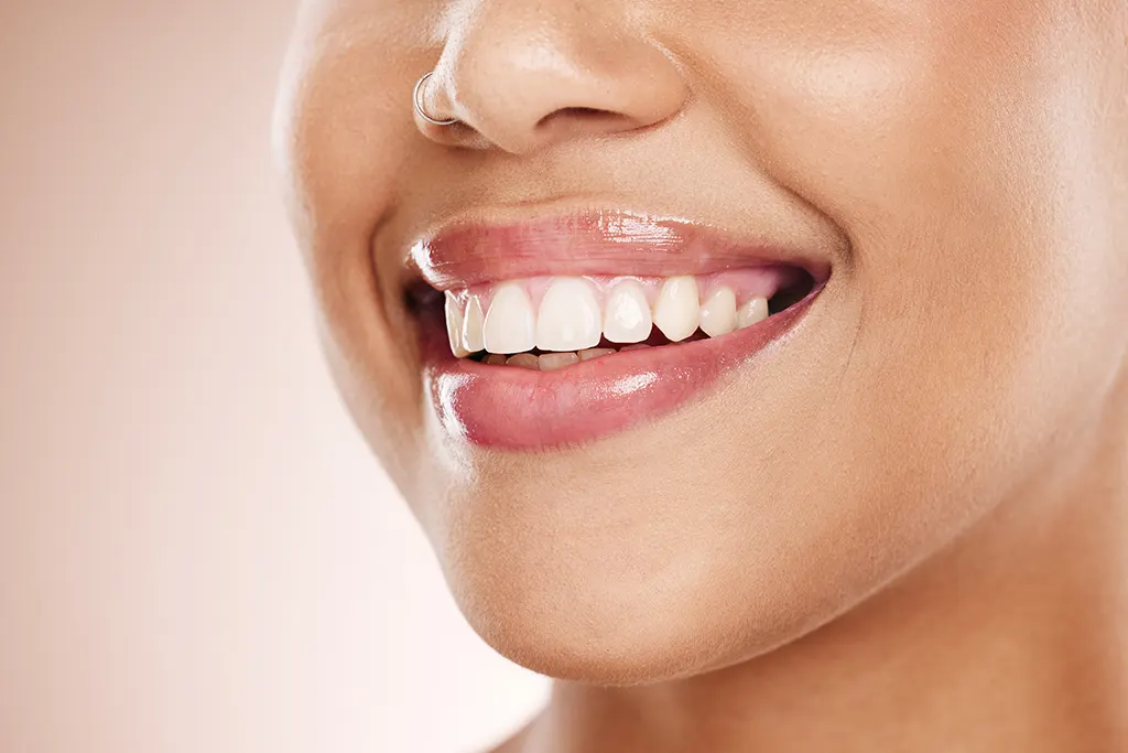 is teeth whitening safe