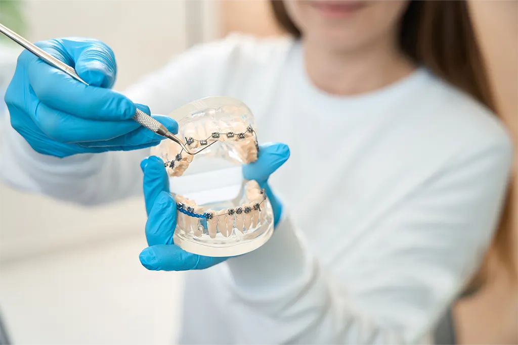 Invisalign vs braces