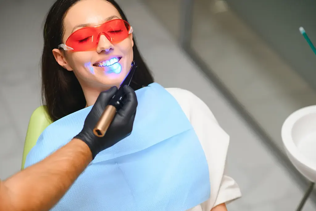 teeth whitening langley