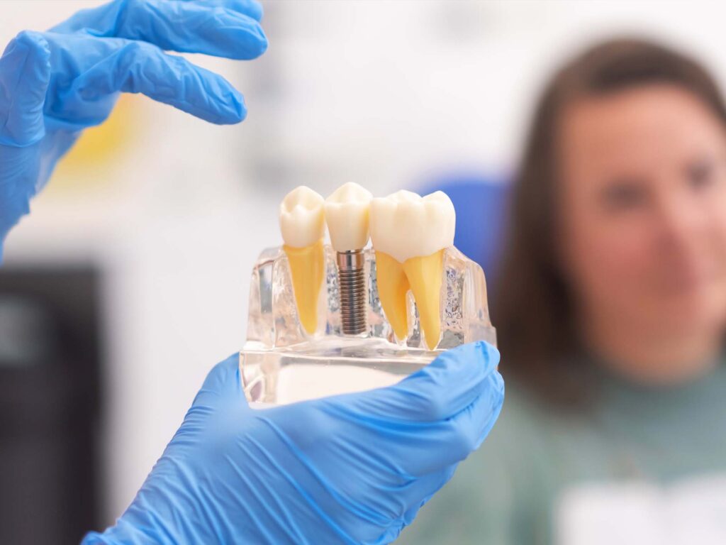 dental implants overview