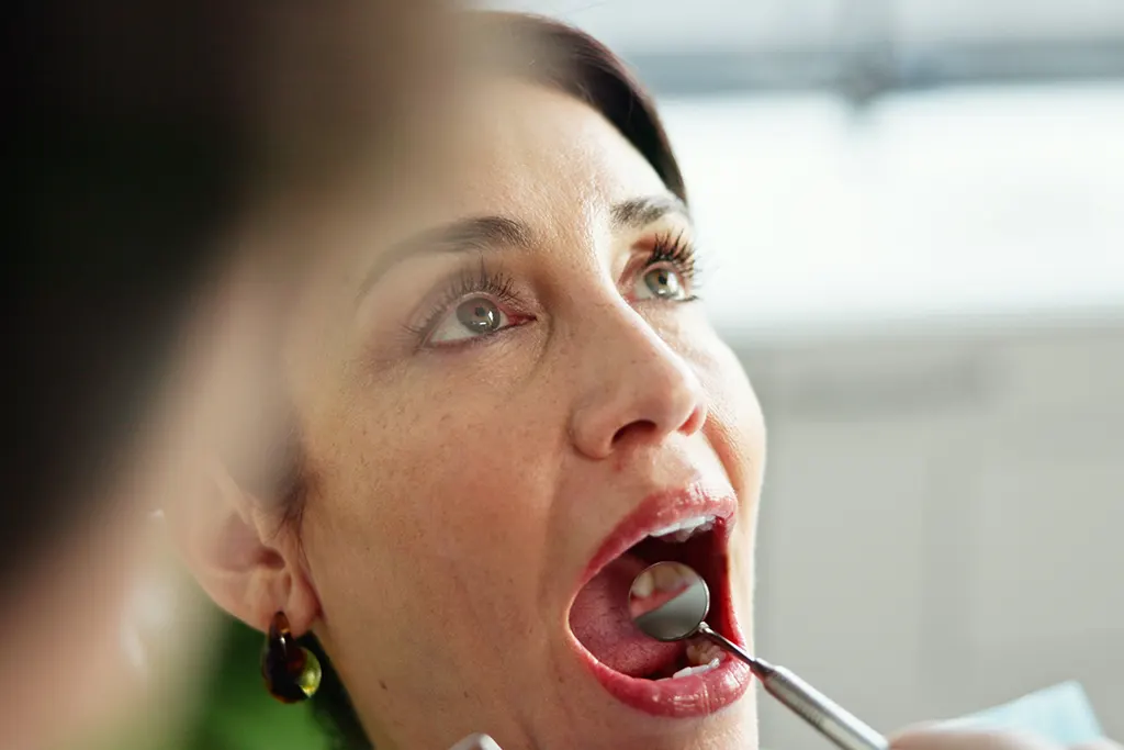 treatments for gum disease